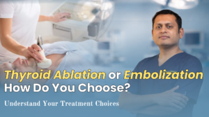 Thyroid Ablation vs Thyroid Embolization: Which Is Right for You?