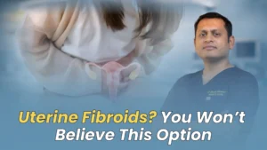 Uterine Fibroid Treatment Options in India